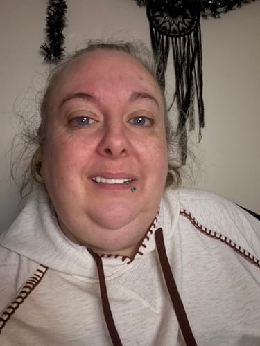 Customer photo review of Pop On Veneers - Custom Made Production