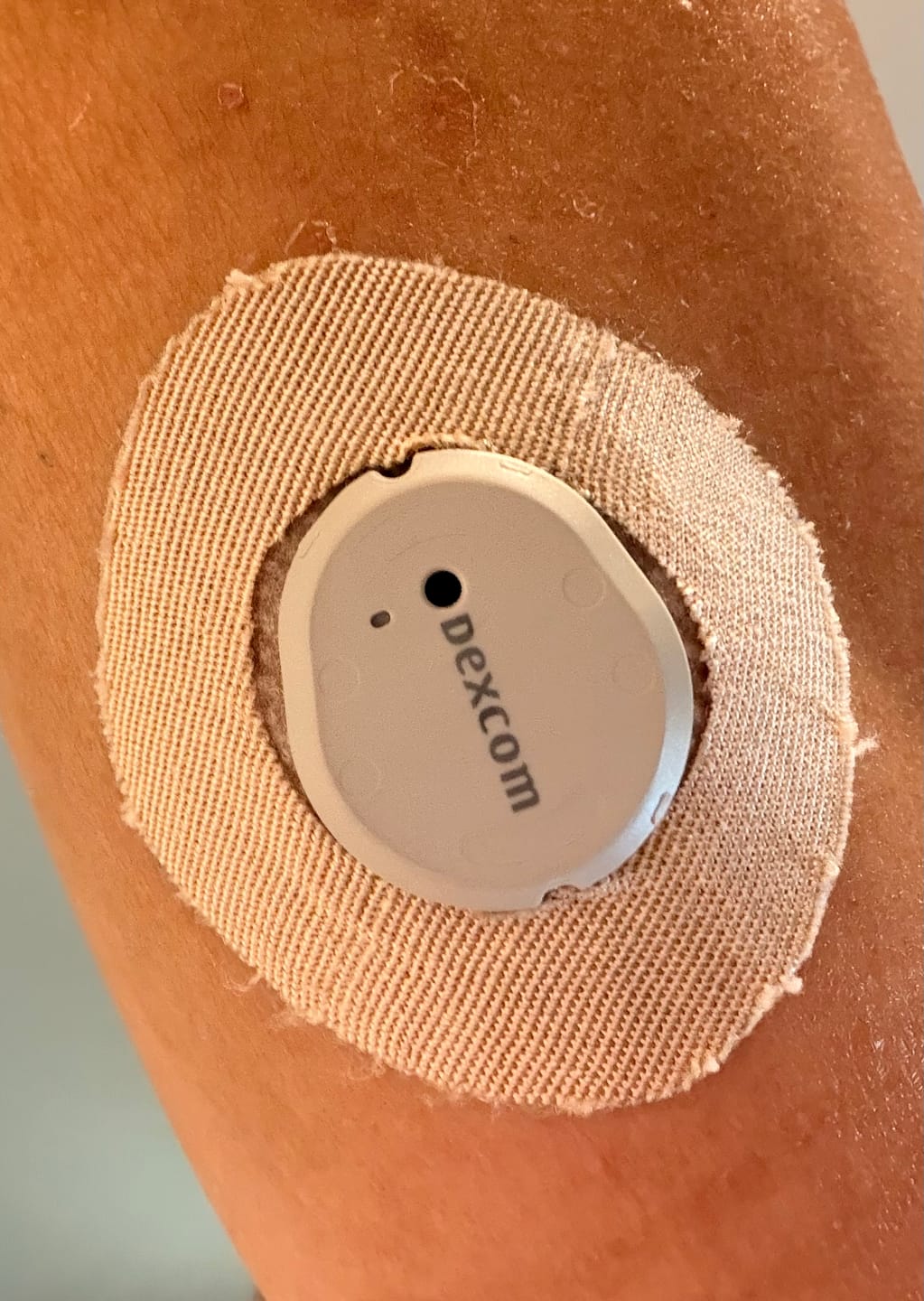 Customer photo review of Skin Grip Original - Dexcom G7 & Stelo Adhesive Patches (With Cutout)