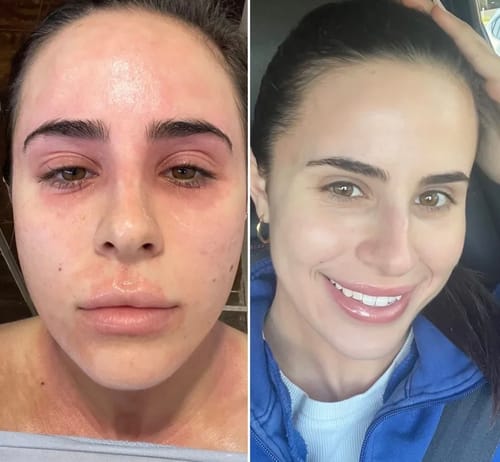 Customer photo review of Orvella™ Soothing Cream