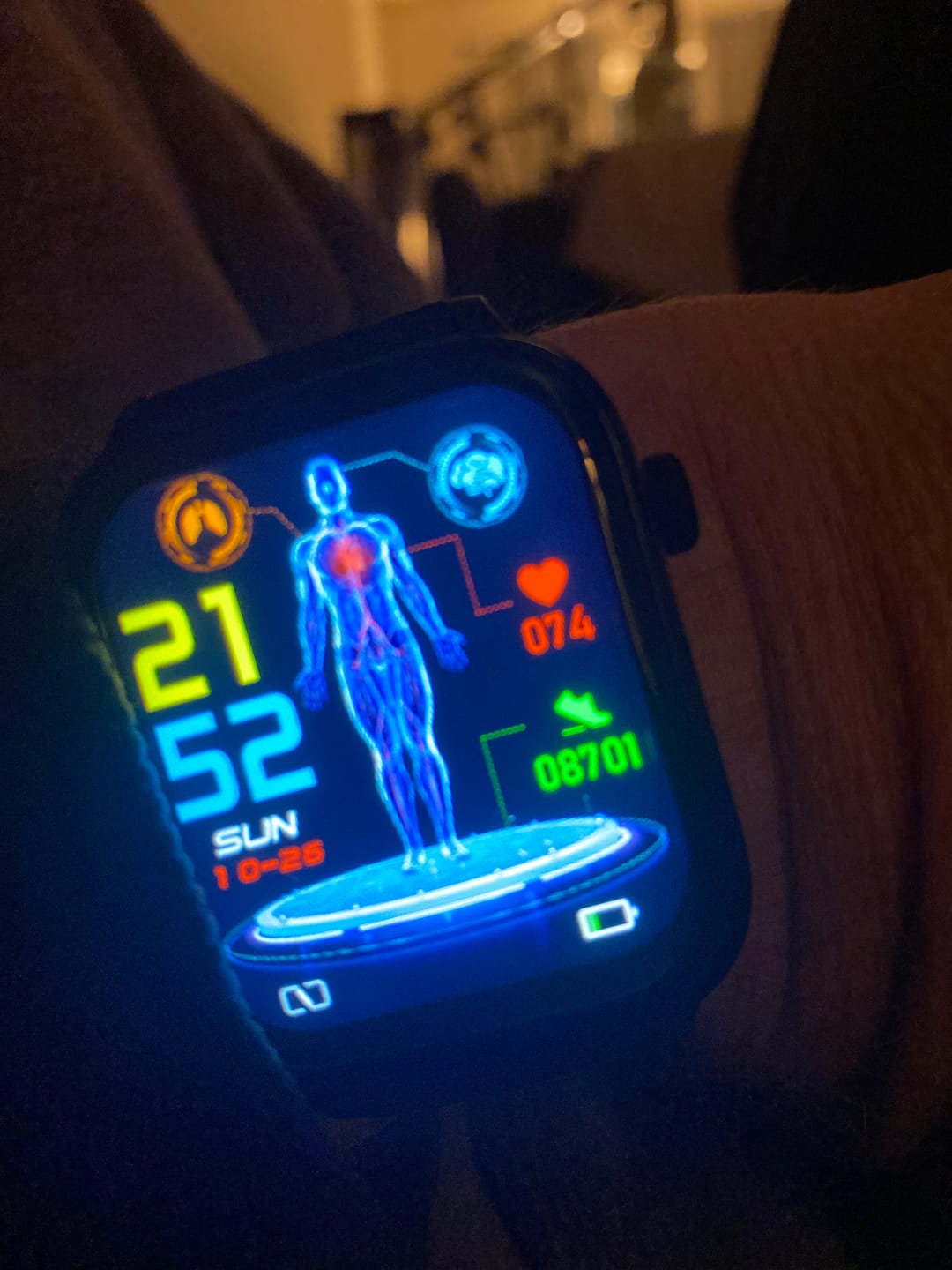 Customer photo review of Bearscome Pro 6 ECG blood glucose Intelligent micro-physical examination Stress monitoring Smartwatch