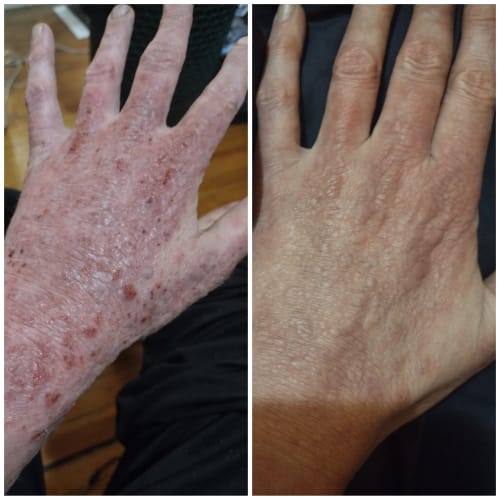 Customer photo review of Orvella™ Soothing Cream