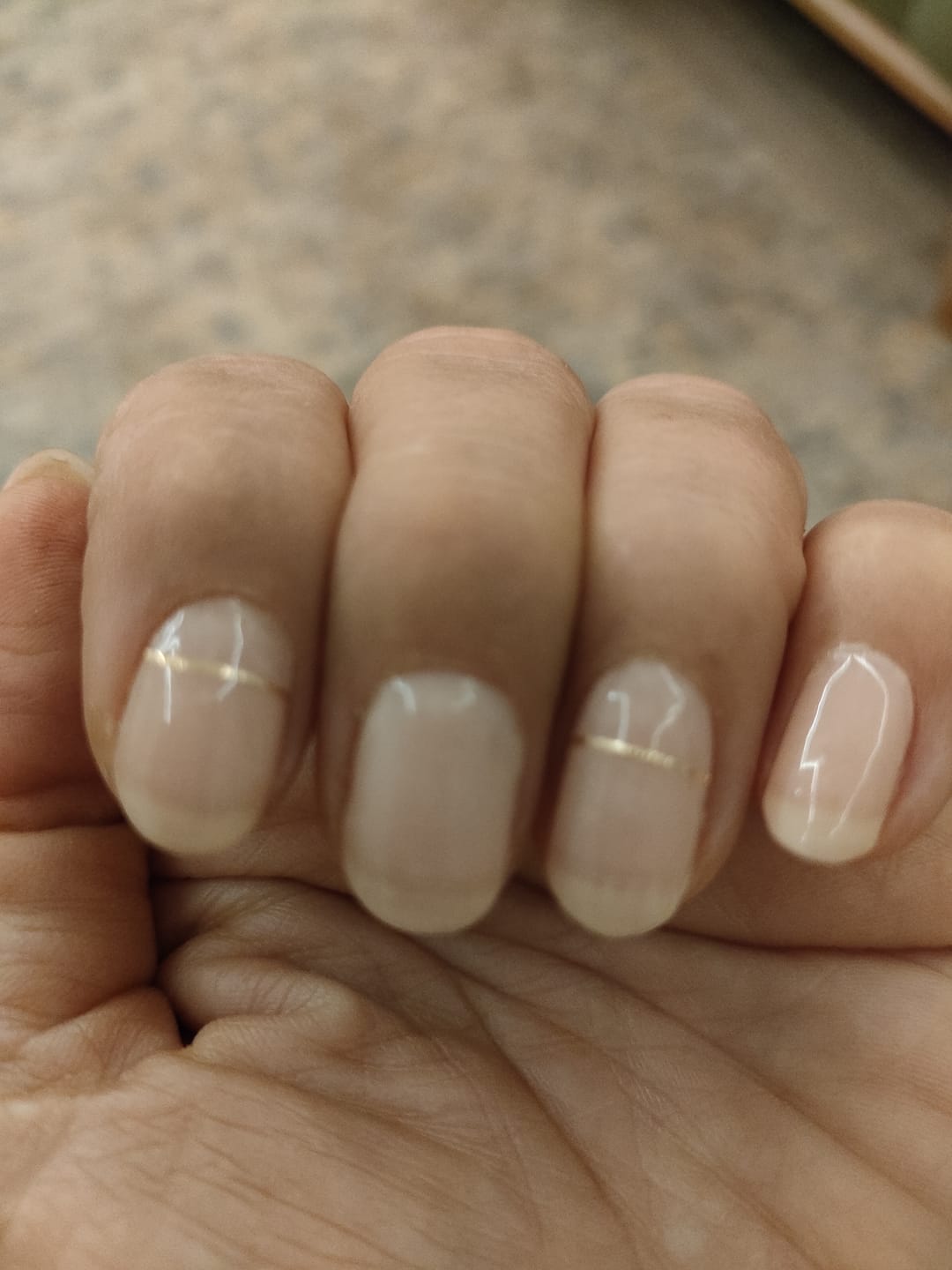 Customer photo review of N Basic Nails no.11 Jel Tırnak 30 Adet, 2 Kullanım