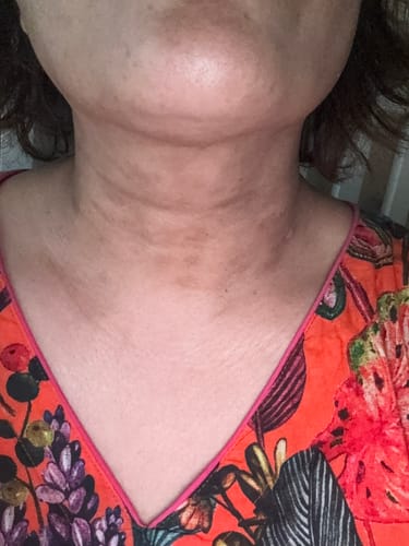 Customer photo review of Turmeric Glow Soap