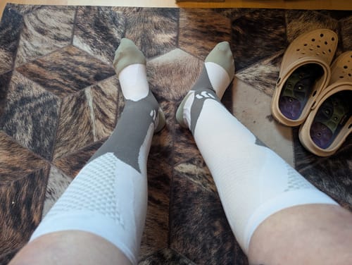 Customer photo review of revitalCare orthopädische Kompressionsstrümpfe