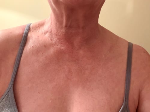 Customer photo review of Besque™ Magic Body Oil - 100ml