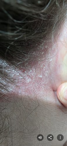 Customer photo review of Seb Natural Calming Serum