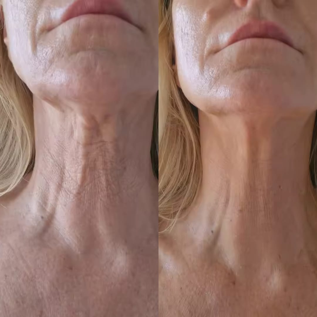Customer photo review of The Naked Skin™ Bounce Balm