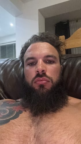 Customer photo review of Seb Natural Soothing Balm