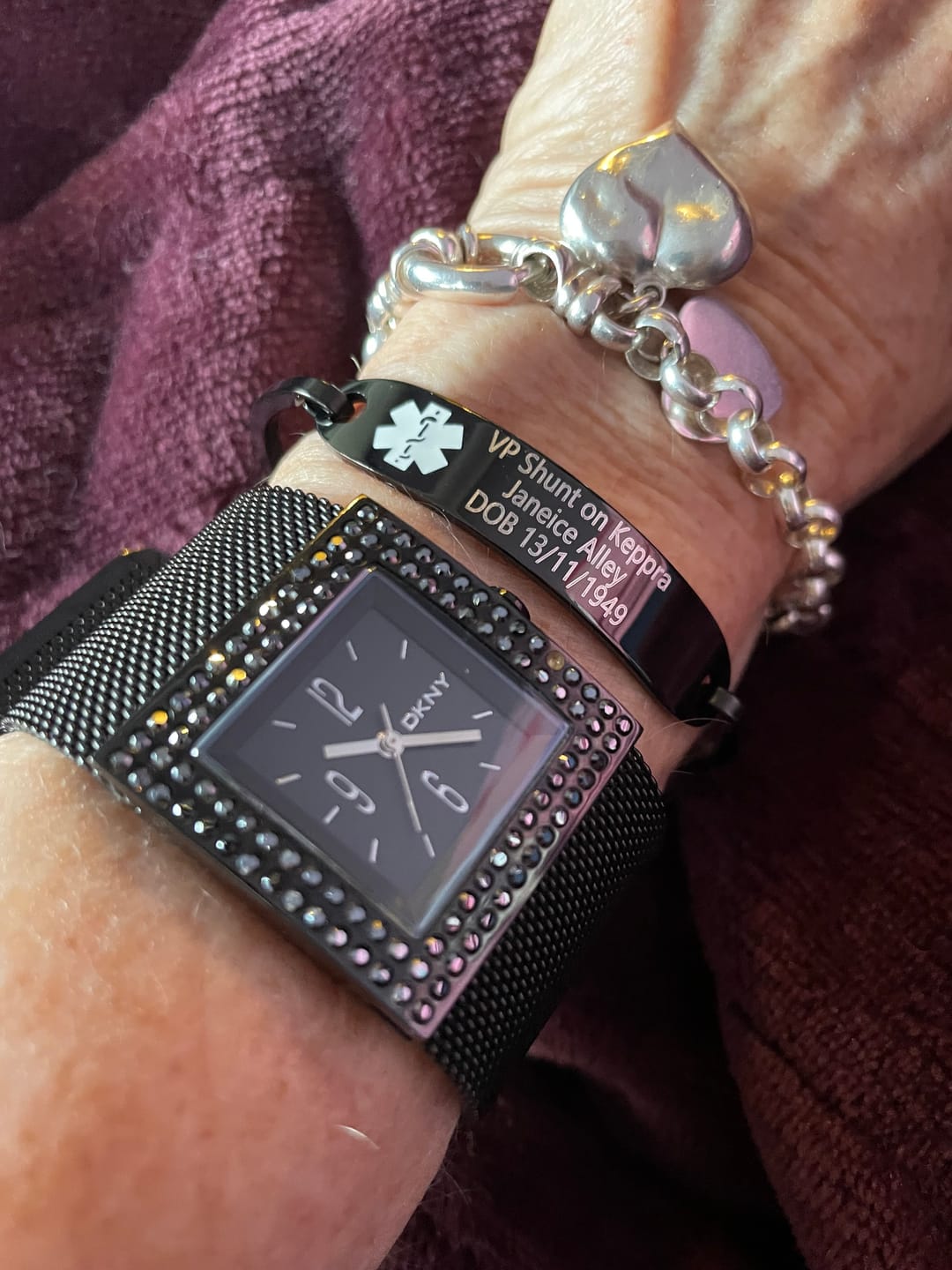 Customer photo review of Personalised Unisex Black Medical Alert ID Bangle Bracelet