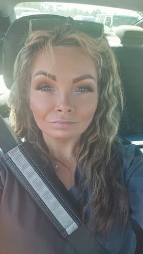 Customer photo review of F-Balm - Premium Anti-aging Tallow Balm - 2 oz.