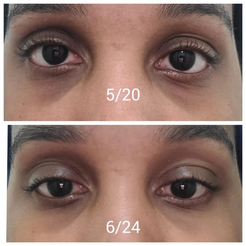 Customer photo review of Dermave™ Eye & Neck Care Set