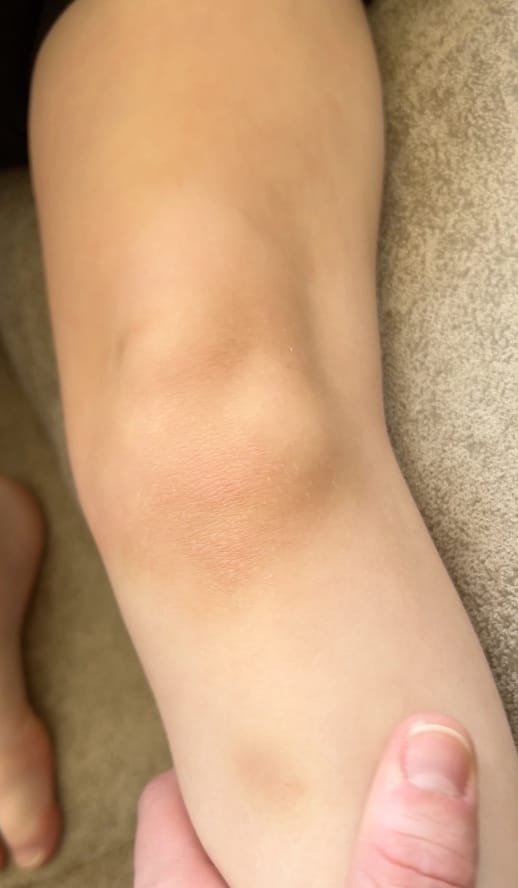 Customer photo review of Skincare Bath Filter by Kinder Filter