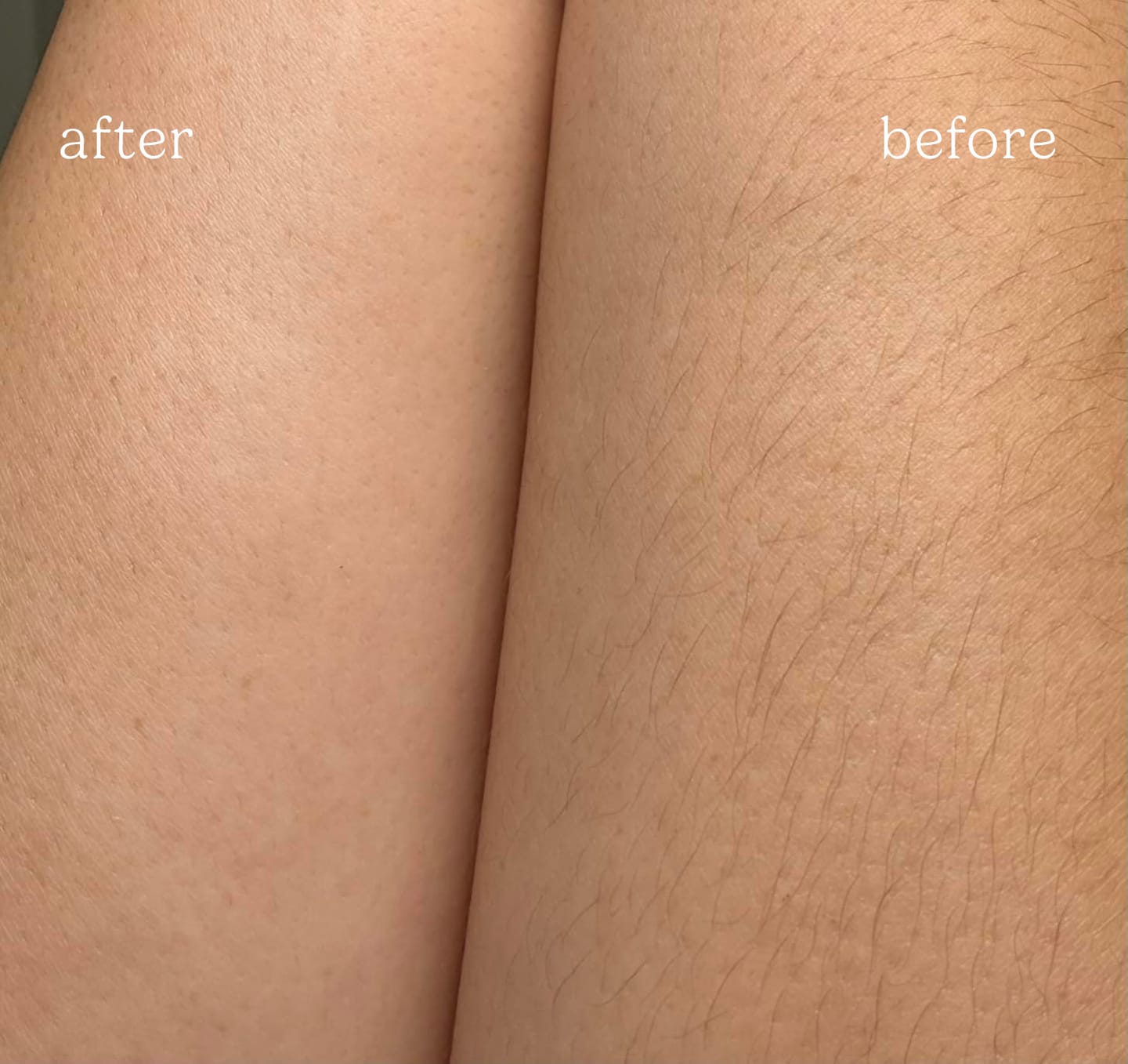 Customer photo review of Dermave™ Electric Trimmer 2.0
