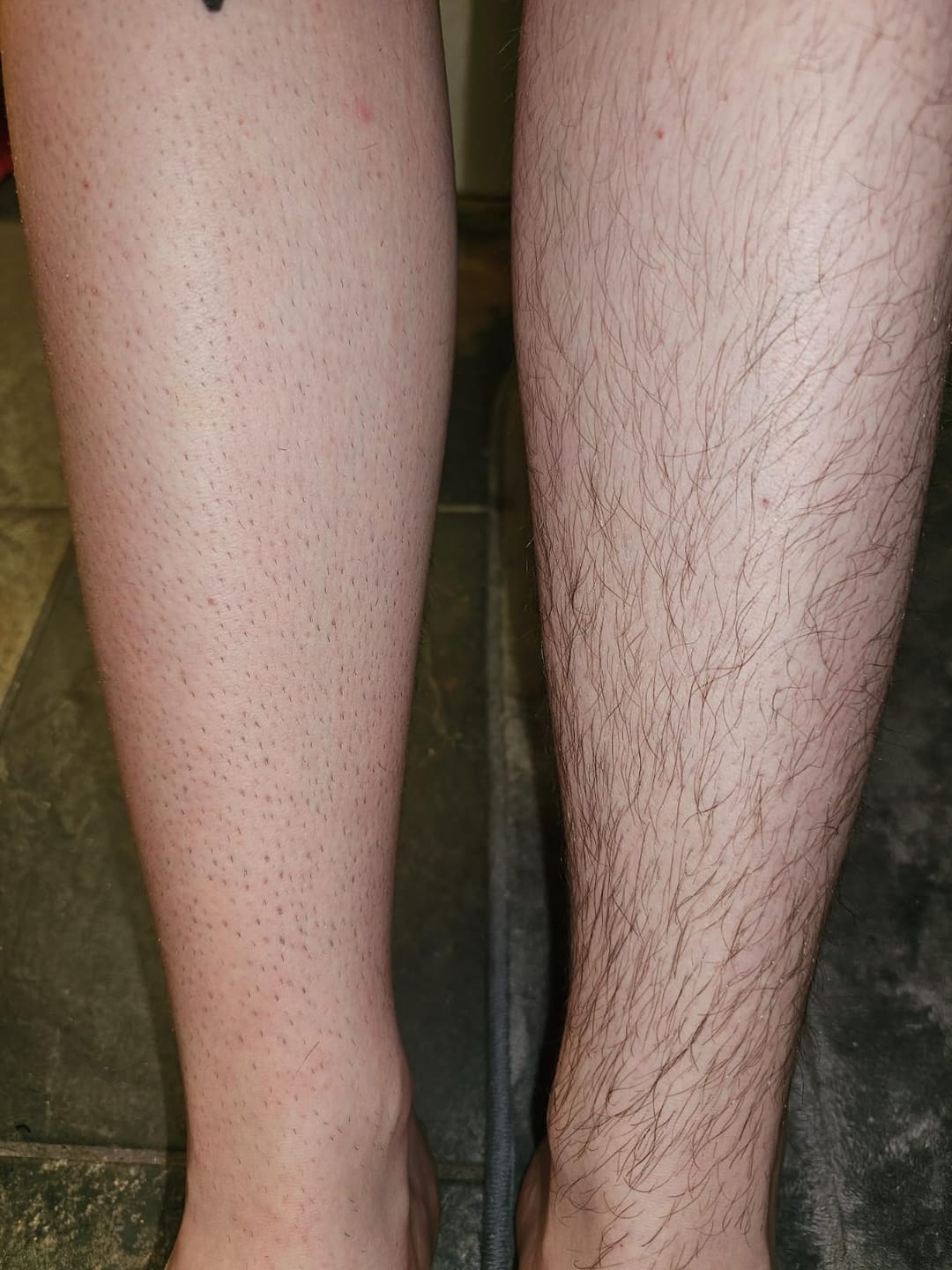 Customer photo review of Dermave™ Electric Trimmer 2.0