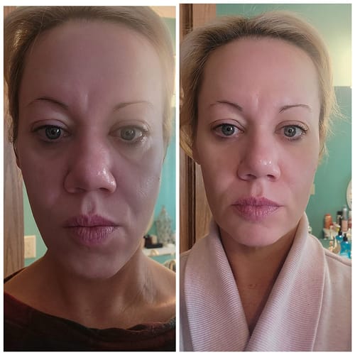 Customer photo review of Dermave™ Eye & Neck Care Set