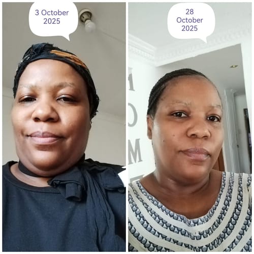 Customer photo review of CheetaThin® Weight Management