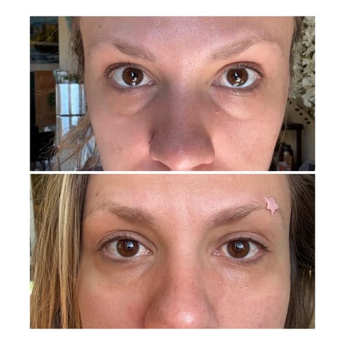 Customer photo review of Dermave™ Eye & Neck Care Set