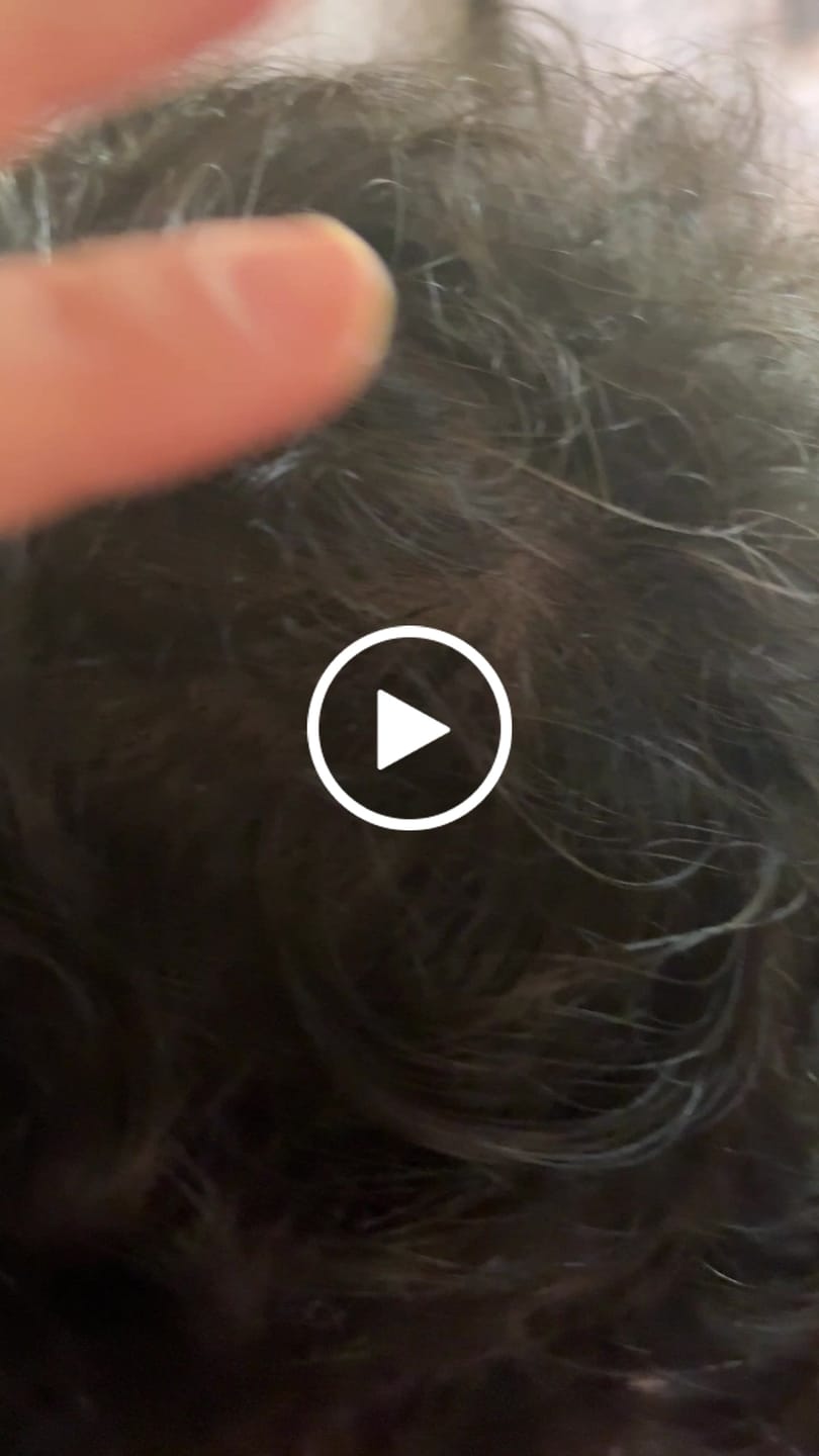 Customer video review of 90 Días de TRÍO ANTIcaída CRECIMIENTO INTENSIVO Bomba y Tónico + 1 Shampoo 70g ENVÍO GRATIS