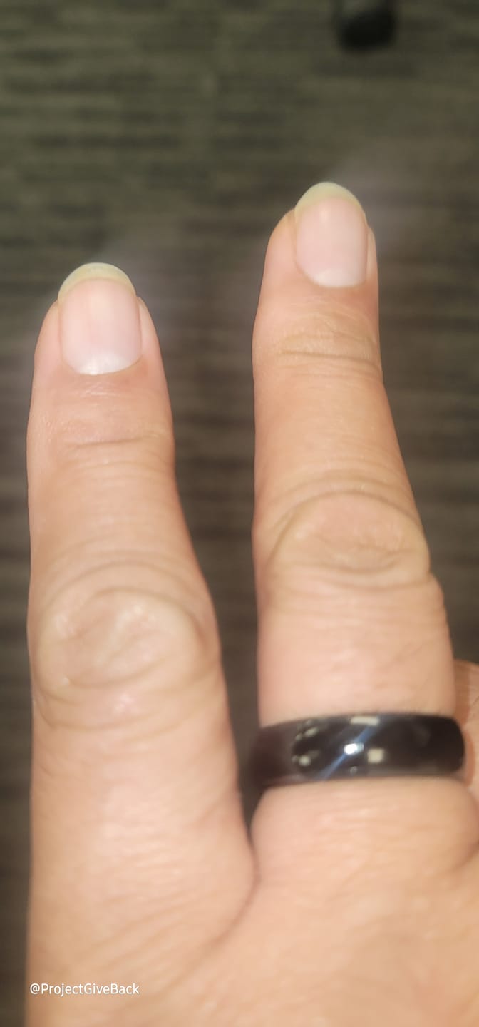 Customer photo review of iTap Ring
