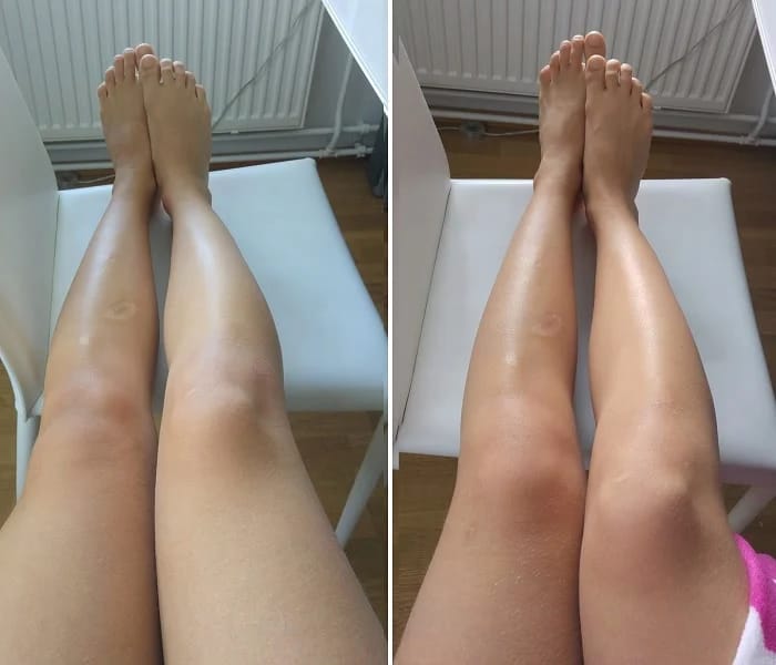 Customer photo review of Glow Tanning Gummies