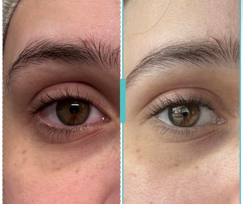 Customer photo review of Dermave™ Eye & Neck Care Set