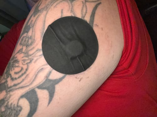 Customer photo review of Skin Tac Adhesive Barrier Wipes – Skin Grip