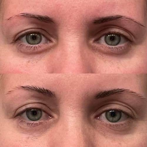 Customer photo review of Dermave™ Eye & Neck Care Set