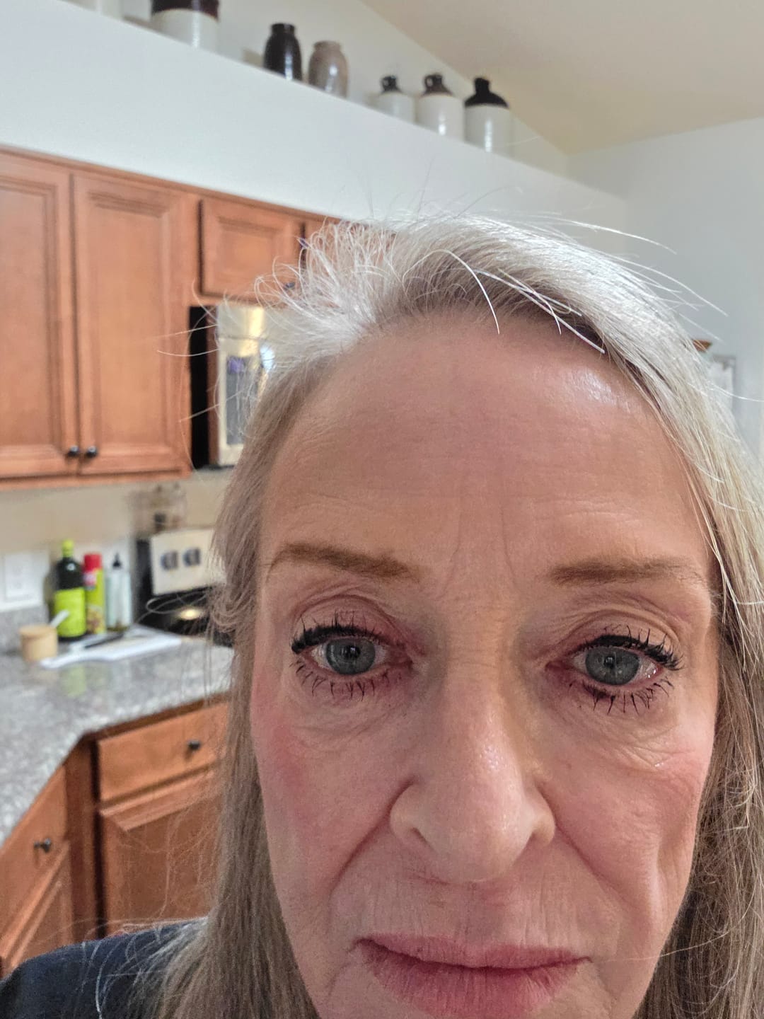 Customer photo review of EYELASH GROWTH SOLUTION