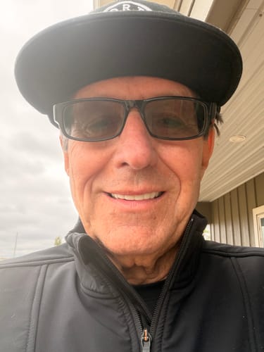 Customer photo review of Pop On Veneers with Impression Kit
