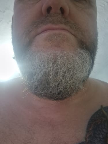 Customer photo review of Seb Natural Calming Serum