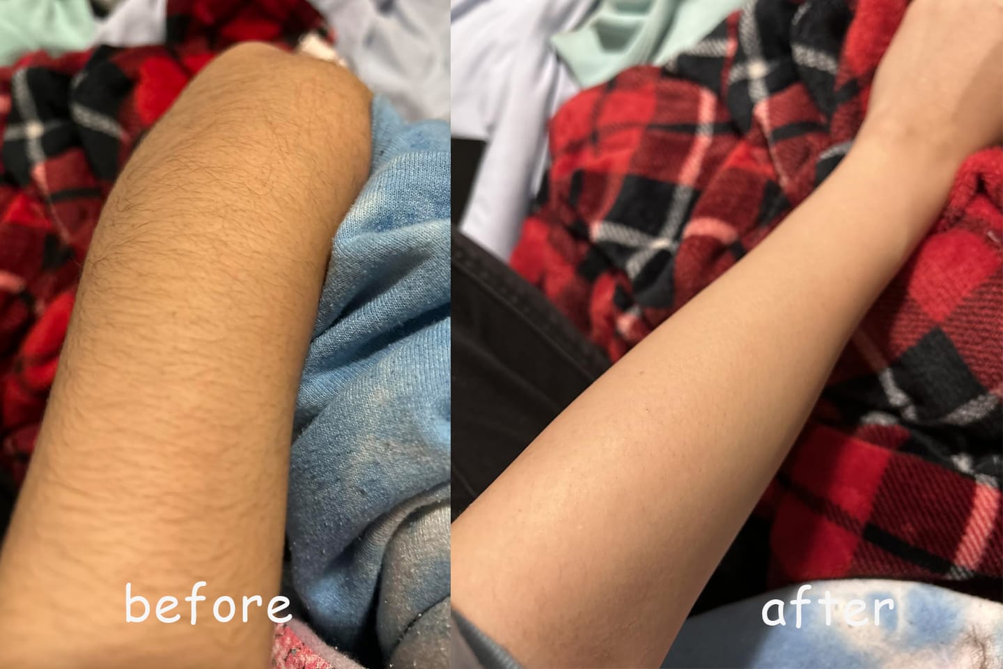 Customer photo review of Dermave™ Electric Trimmer 2.0