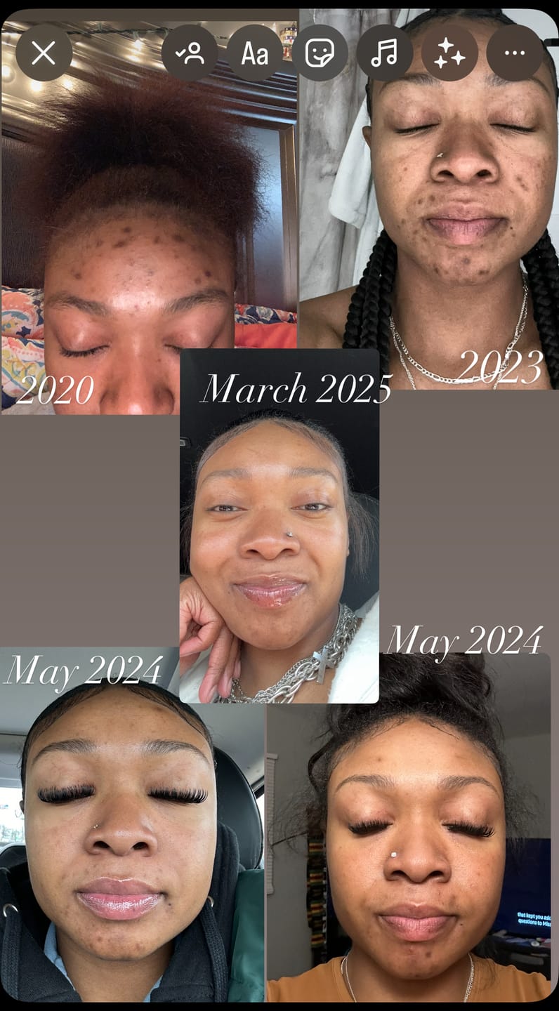Customer photo review of Melanin Skin Bundle (40% off)