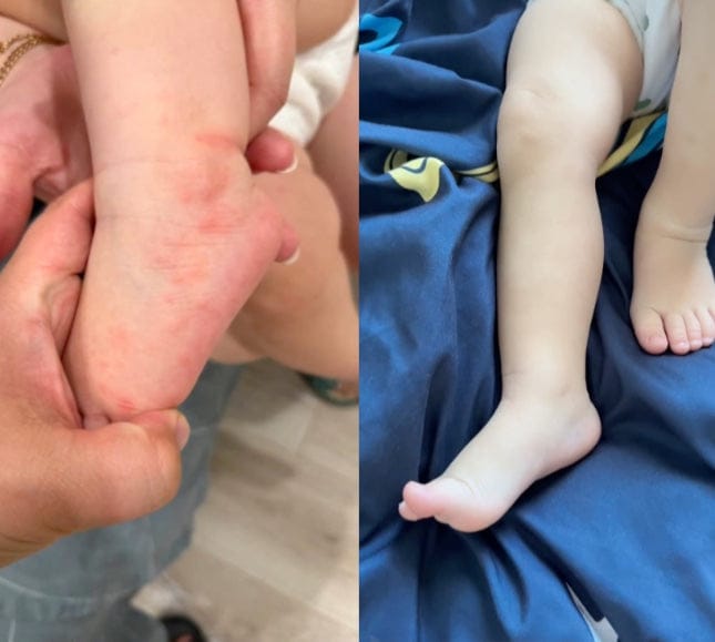 Customer photo review of Skincare Bath Filter by Kinder Filter