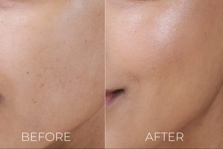Customer photo review of Spectra Matt SC SPF 40