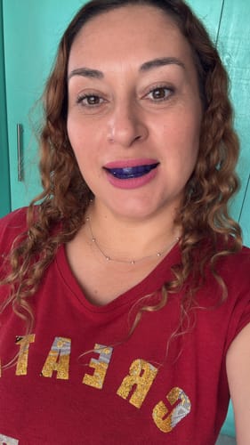 Customer photo review of Tratamiento VITTÉ 42 días