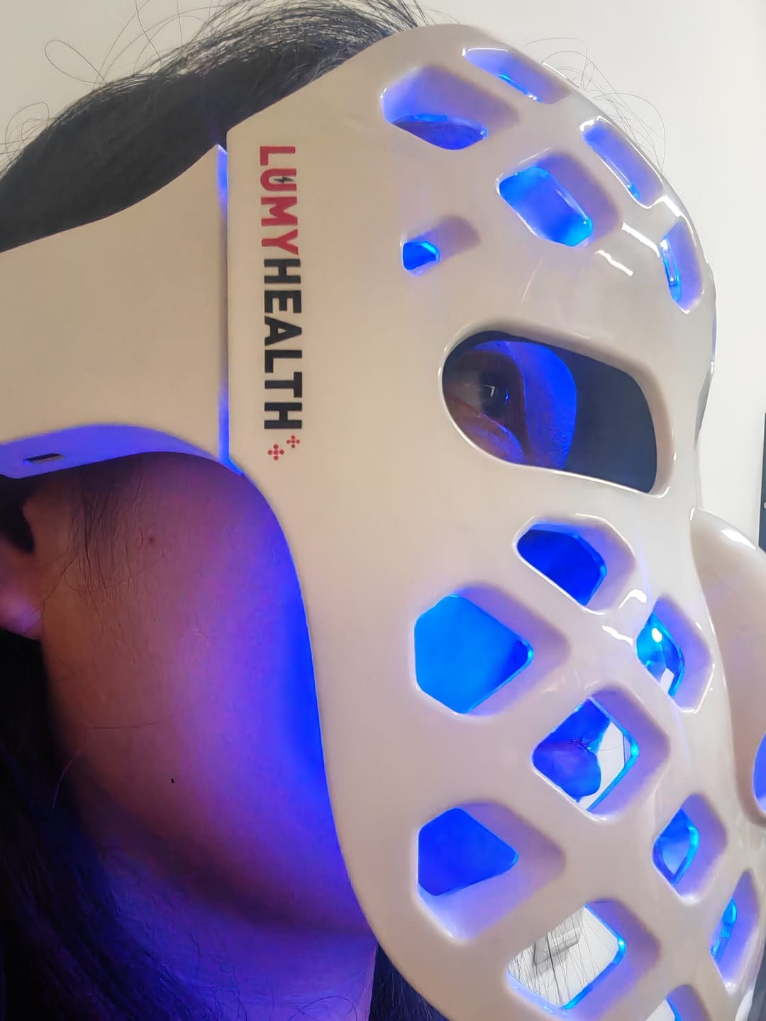 Customer photo review of LumyHealth 5D Rejuvenating Beauty Mask