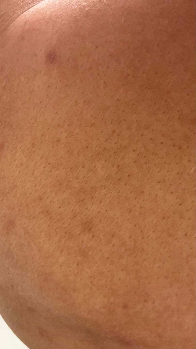Customer photo review of Ventamin Clear It™