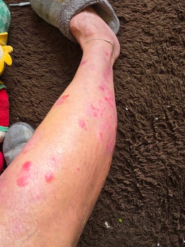 Customer photo review of Multi Strain Biotic