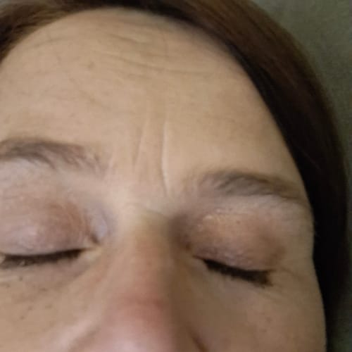 Customer photo review of iGlow Lash Maximizer - Lash Serum, 3 ml