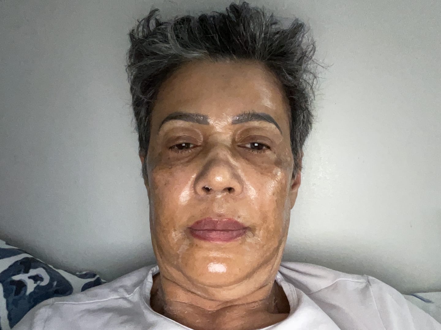 Customer photo review of Collagen Fit™ - Máscara Rejuvenescedora de Colagénio