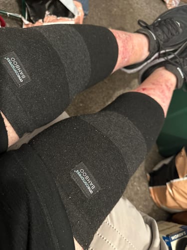 Customer photo review of Premium Bamboo Knee Sleeve (Single)
