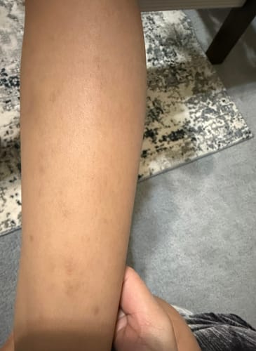 Customer photo review of CHIKITING SOAP