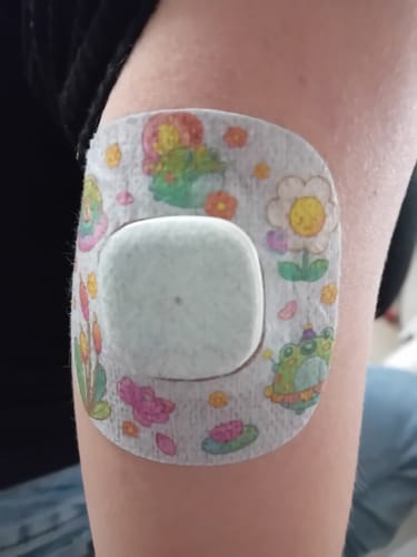 Customer photo review of Simplera Sensor Patch - Patch Me UP - Kids Serie
