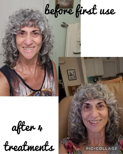 Customer photo review of Deep Collagen Cream