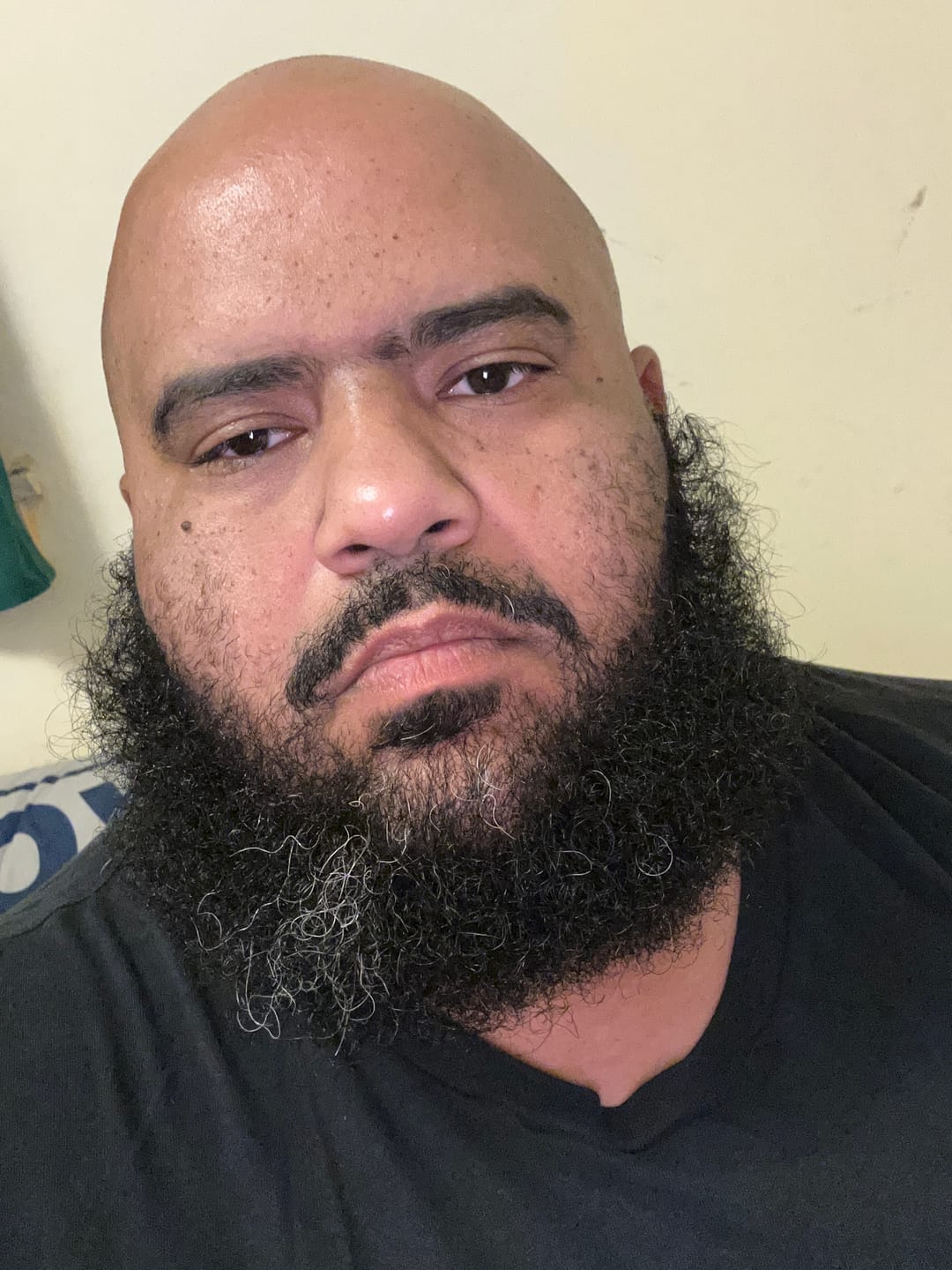 Customer photo review of Razor Bump Solution