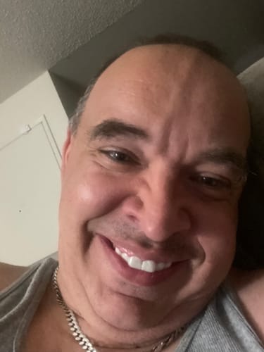 Customer photo review of Pop On Veneers with Impression Kit