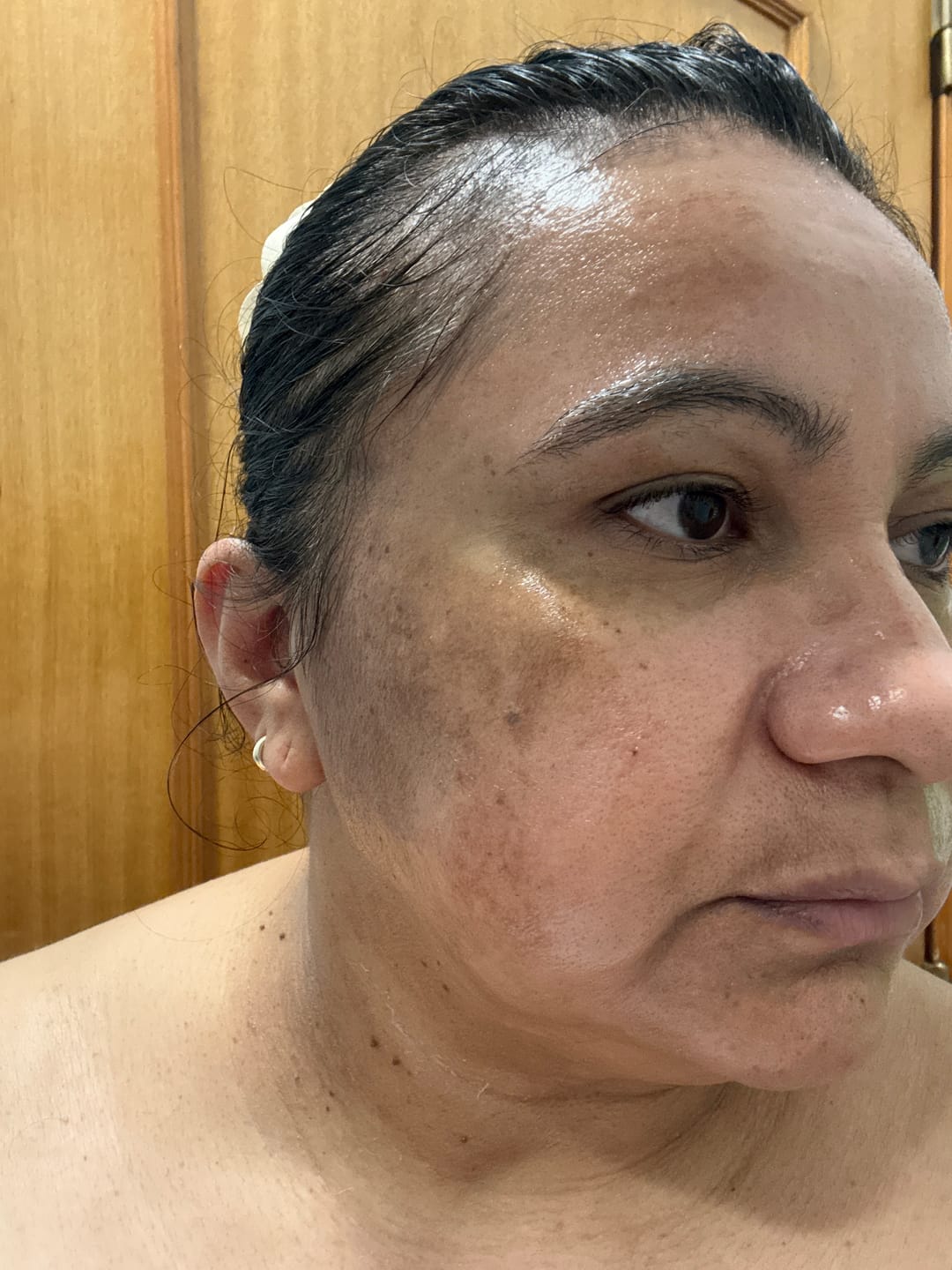 Customer photo review of Collagen Fit™ - Máscara Rejuvenescedora de Colagénio