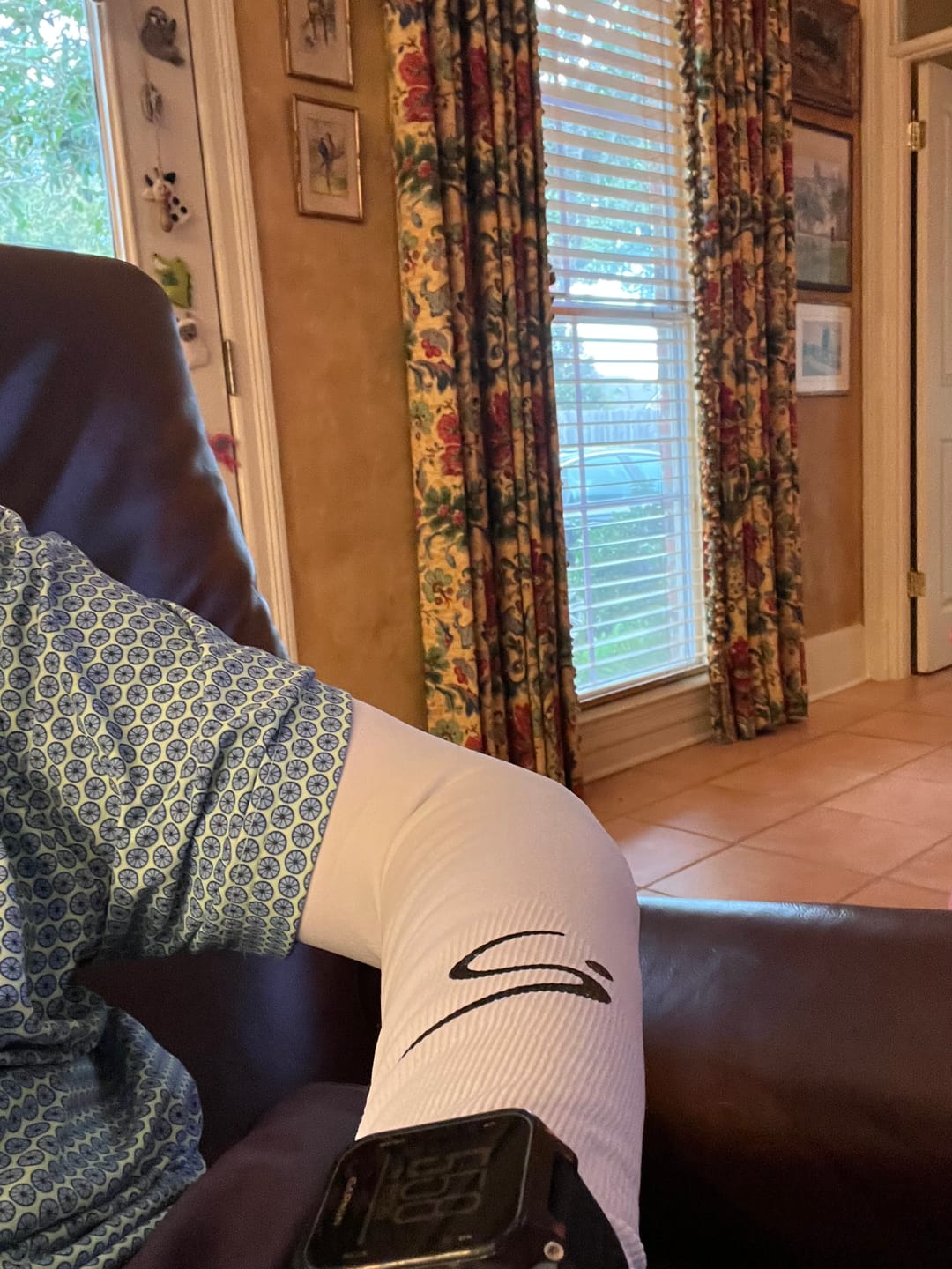 Customer photo review of STORYi Sun Sleeves – White/Black