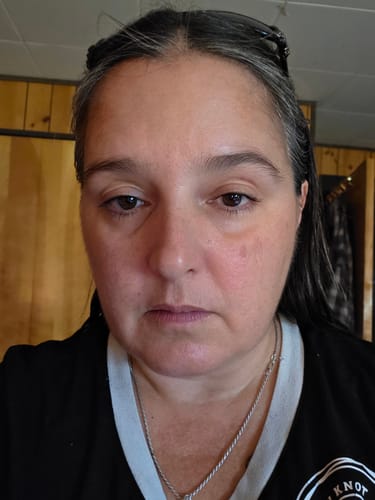 Customer photo review of *LIMITED TIME* TryTallow™️ Wrinkle and Acne Fighting Tallow Balm 4oz (Pumpkin Pie Scented)