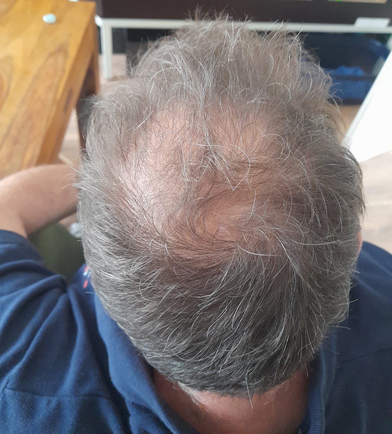 Customer photo review of Ansatzpuder von IMPERIO® | Wasserfeste Qualität